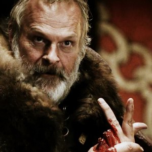 GreatJon losees 2 fingers